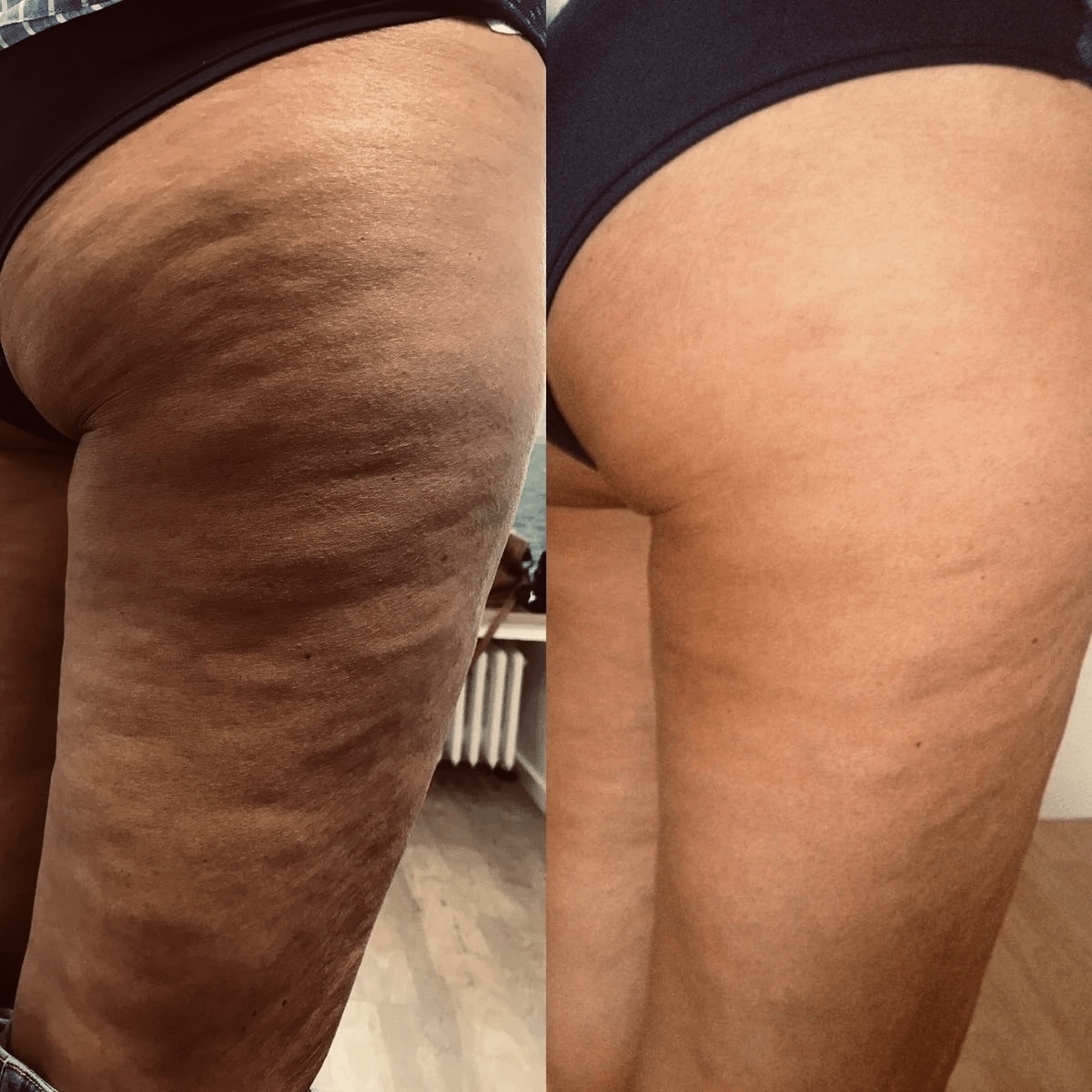 Profesionální ošetření v našem salonu